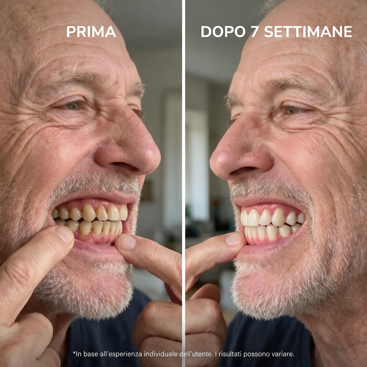 Ripristina la Salute del Tuo Sorriso in 12 Minuti al Giorno - BioGum™
